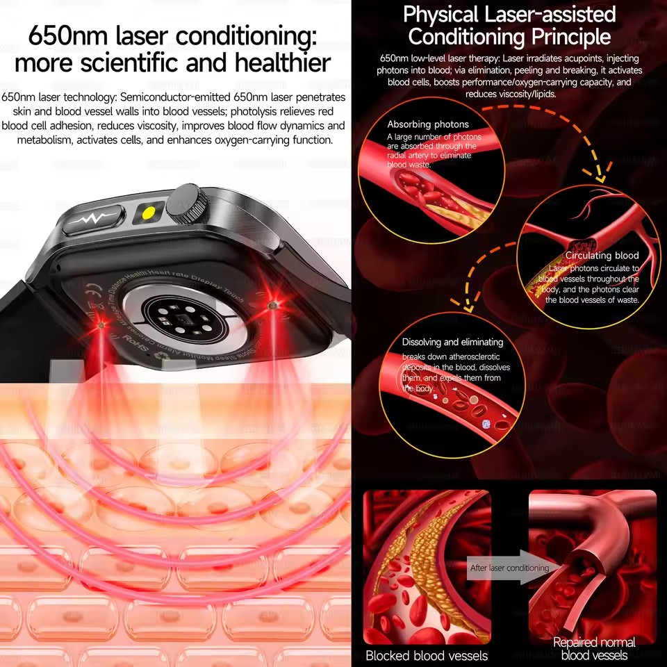 2026 New Health Smart Watch La - đánh giá và giá Industrial Laser Beam