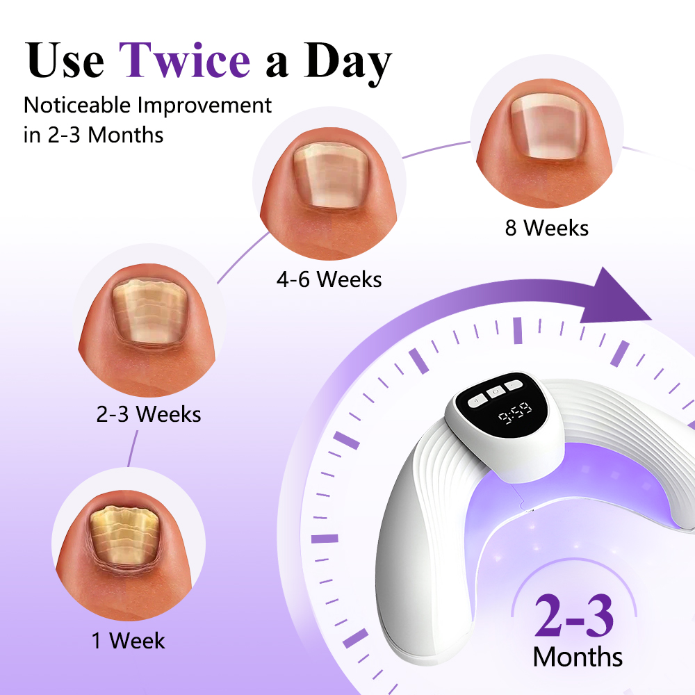 2-in-1 Nail Fungus Laser Devic - đánh giá và giá Industrial Laser Removal